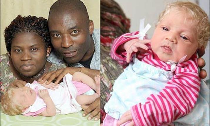 Un cuplu de africani a adus pe lume un copil alb ca zapada. Cum a fost posibil?